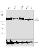 TSC2 Antibody in Western Blot (WB)