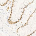 CHK2 Antibody in Immunohistochemistry (Paraffin) (IHC (P))