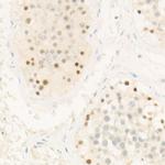 CHK2 Antibody in Immunohistochemistry (Paraffin) (IHC (P))