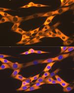 HSP90 beta Antibody in Immunocytochemistry (ICC/IF)