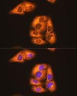 HSP90 beta Antibody in Immunocytochemistry (ICC/IF)