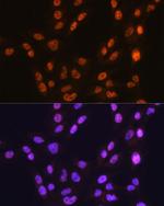 CTCF Antibody in Immunocytochemistry (ICC/IF)