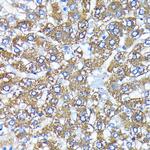 ATG3 Antibody in Immunohistochemistry (Paraffin) (IHC (P))