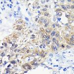 ATG3 Antibody in Immunohistochemistry (Paraffin) (IHC (P))