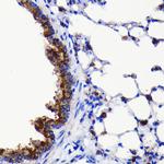 ATG3 Antibody in Immunohistochemistry (Paraffin) (IHC (P))