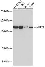 NFATC1 Antibody in Western Blot (WB)