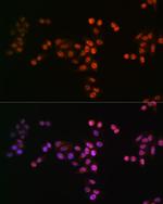 Drosha Antibody in Immunocytochemistry (ICC/IF)