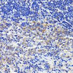 ATG7 Antibody in Immunohistochemistry (Paraffin) (IHC (P))