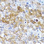 ATG7 Antibody in Immunohistochemistry (Paraffin) (IHC (P))