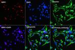 Vimentin Antibody in Immunocytochemistry (ICC/IF)