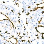 Vimentin Antibody in Immunohistochemistry (Paraffin) (IHC (P))