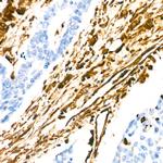 Vimentin Antibody in Immunohistochemistry (Paraffin) (IHC (P))