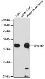 Vimentin Antibody in Immunoprecipitation (IP)