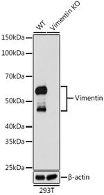 Vimentin Antibody