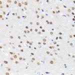 Cullin 3 Antibody in Immunohistochemistry (Paraffin) (IHC (P))