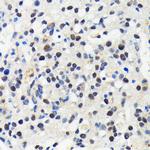 Cullin 3 Antibody in Immunohistochemistry (Paraffin) (IHC (P))