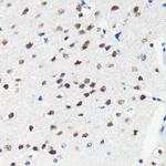 Cullin 3 Antibody in Immunohistochemistry (Paraffin) (IHC (P))