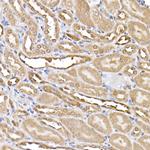 ERK2 Antibody in Immunohistochemistry (Paraffin) (IHC (P))