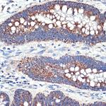 FIS1 Antibody in Immunohistochemistry (Paraffin) (IHC (P))