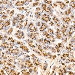 Cathepsin D Antibody in Immunohistochemistry (Paraffin) (IHC (P))