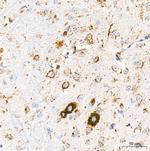 Cathepsin D Antibody in Immunohistochemistry (Paraffin) (IHC (P))