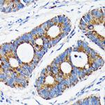 BAX Antibody in Immunohistochemistry (Paraffin) (IHC (P))