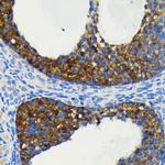 cIAP1 Antibody in Immunohistochemistry (Paraffin) (IHC (P))