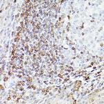 BCL-2 Antibody in Immunohistochemistry (Paraffin) (IHC (P))