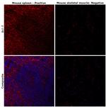 BCL-2 Antibody