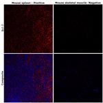 BCL-2 Antibody