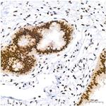 PIM1 Antibody in Immunohistochemistry (Paraffin) (IHC (P))