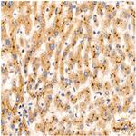 PIM1 Antibody in Immunohistochemistry (Paraffin) (IHC (P))