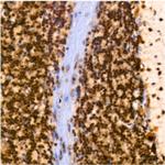 PIM1 Antibody in Immunohistochemistry (Paraffin) (IHC (P))