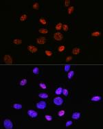 HDAC9 Antibody in Immunocytochemistry (ICC/IF)