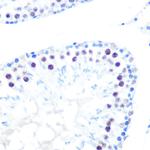 HDAC9 Antibody in Immunohistochemistry (Paraffin) (IHC (P))