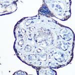 N-WASP Antibody in Immunohistochemistry (Paraffin) (IHC (P))