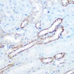 N-WASP Antibody in Immunohistochemistry (Paraffin) (IHC (P))