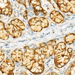 GCN2 Antibody in Immunohistochemistry (Paraffin) (IHC (P))