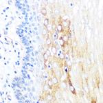 ROCK2 Antibody in Immunohistochemistry (Paraffin) (IHC (P))