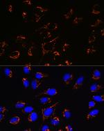 PRDX3 Antibody in Immunocytochemistry (ICC/IF)