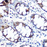 PRDX3 Antibody in Immunohistochemistry (Paraffin) (IHC (P))