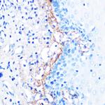 TGFBI Antibody in Immunohistochemistry (Paraffin) (IHC (P))