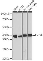 RAD51 Antibody in Western Blot (WB)