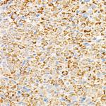 TFAM Antibody in Immunohistochemistry (Paraffin) (IHC (P))