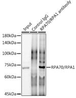 RPA70 Antibody in Immunoprecipitation (IP)