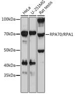 RPA70 Antibody in Western Blot (WB)