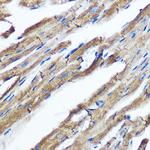 IKK epsilon Antibody in Immunohistochemistry (Paraffin) (IHC (P))