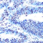 PTBP1 Antibody in Immunohistochemistry (Paraffin) (IHC (P))