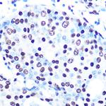 SFPQ Antibody in Immunohistochemistry (Paraffin) (IHC (P))