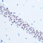 TLE1 Antibody in Immunohistochemistry (Paraffin) (IHC (P))